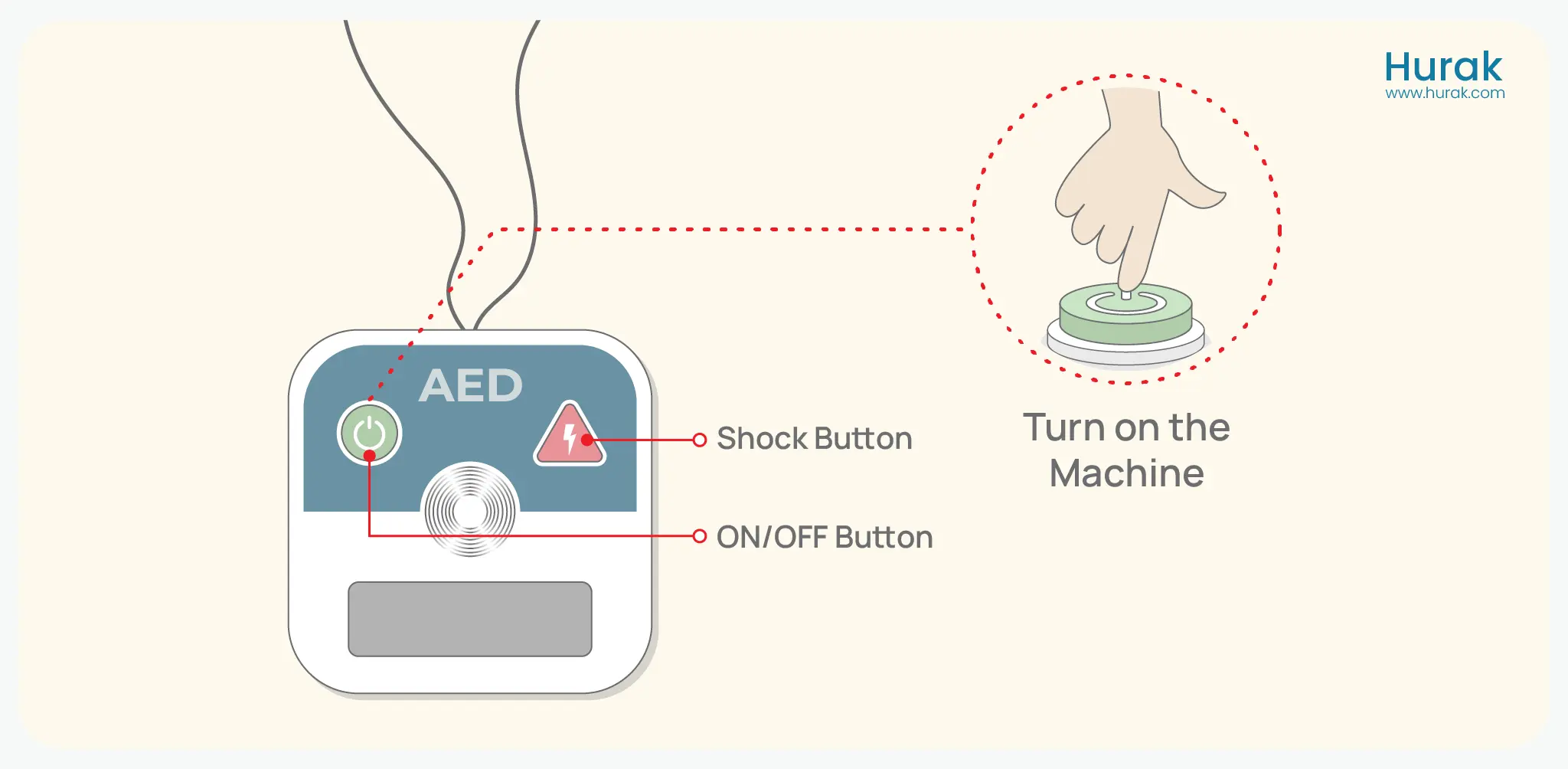 Step1 switch on the defibrillator