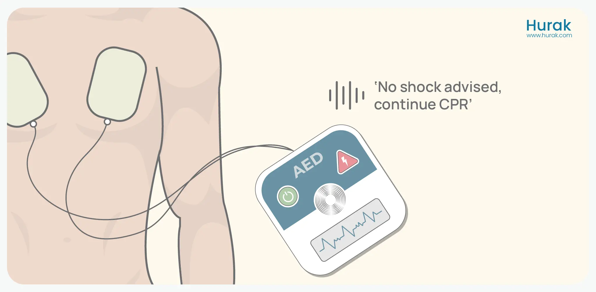 Step 6 voice command